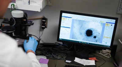 Cientistas criam mini coração humano em laboratório que reproduz fibrilação atrial e pode acelerar desenvolvimento de tratamentos